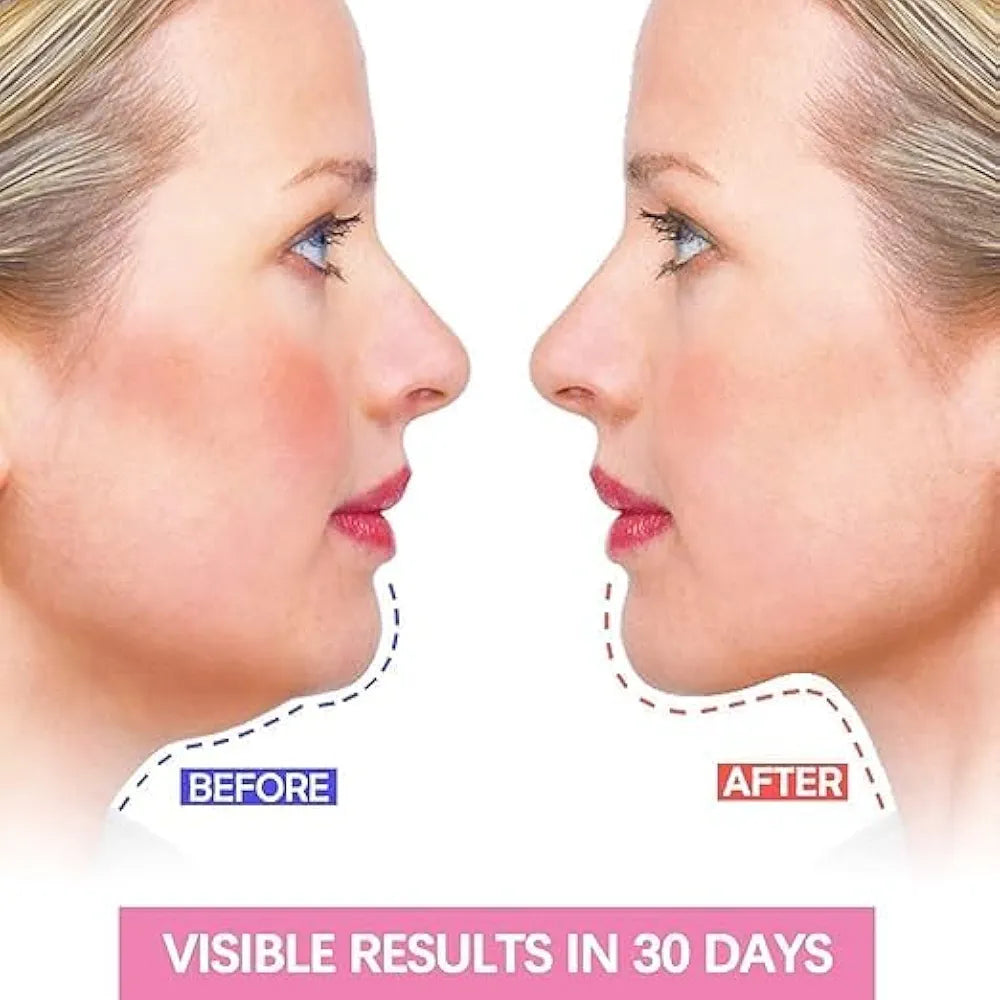 Double Chin Reducer & Face Lift-Up Belt